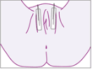 Electrastim Vaginal & Penis Klebeelektroden