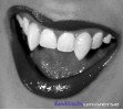 Lady Vampire Z�hne